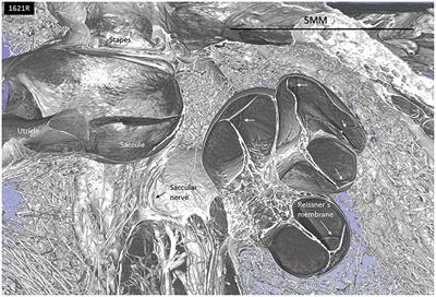 Vestibular Organ and Cochlear Implantation–A Synchrotron and Micro-CT Study